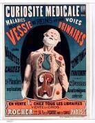 Curiosité médicale (anonyme) - Muzeo.com